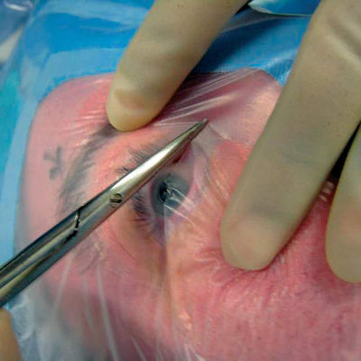 ستائر جراحية معقمة قابلة للتشكيل يمكن التخلص منها مع حامل كابل