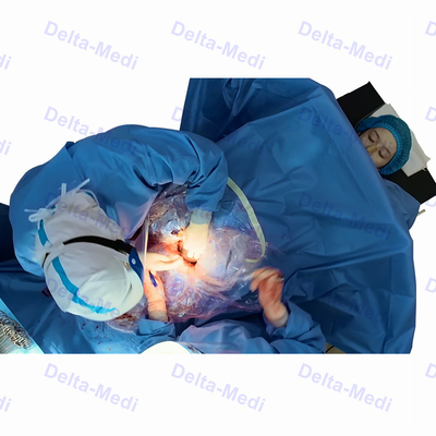 ستارة معقمة جراحية C القسم مع حزمة ثنى لأمراض النساء والتوليد